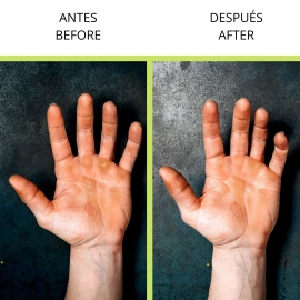 Velites Stone Callus Remover